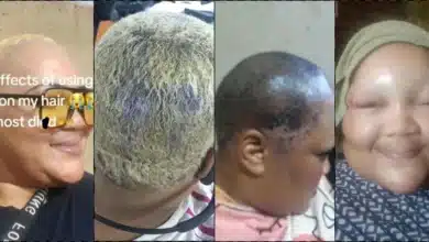 Woman shares aftereffect of bleaching her hair