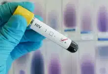 Four dead after allegedly using herbal cure for HIV in Gombe