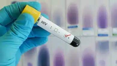 Four dead after allegedly using herbal cure for HIV in Gombe