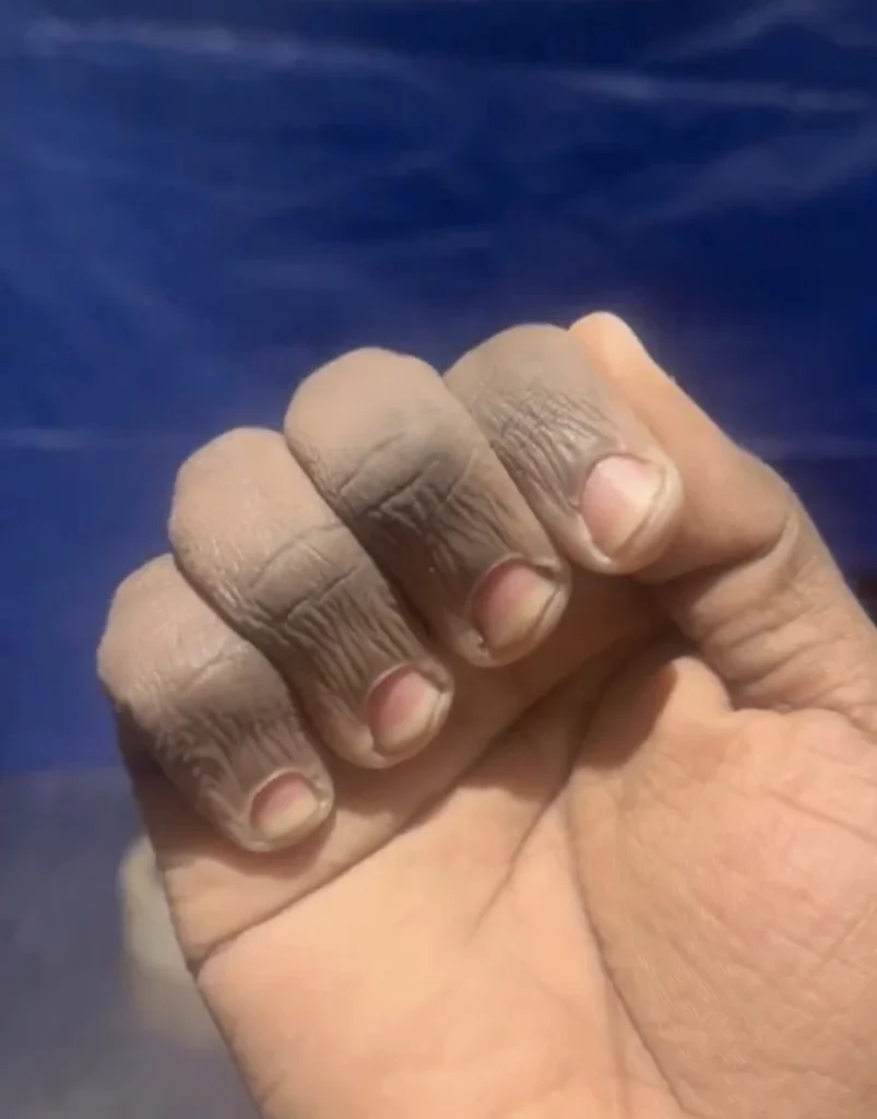 Man shows off state of his hands after washing plates to pay school fees in the UK