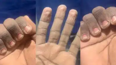 Man shows off state of his hands after washing plates to pay school fees in the UK