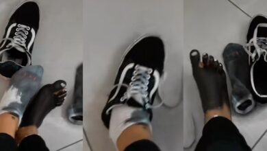 "RIP to my socks" - Lady expresses shock as white socks, her leg changes color after shoe purchase at Nairobi street