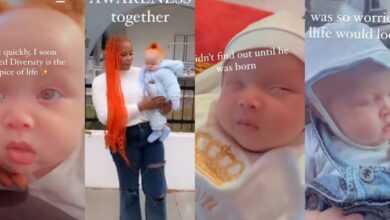 "His red hair, he's so handsome" - Nigerian lady breaks the internet as she shows off handsome son with type 3 albinism