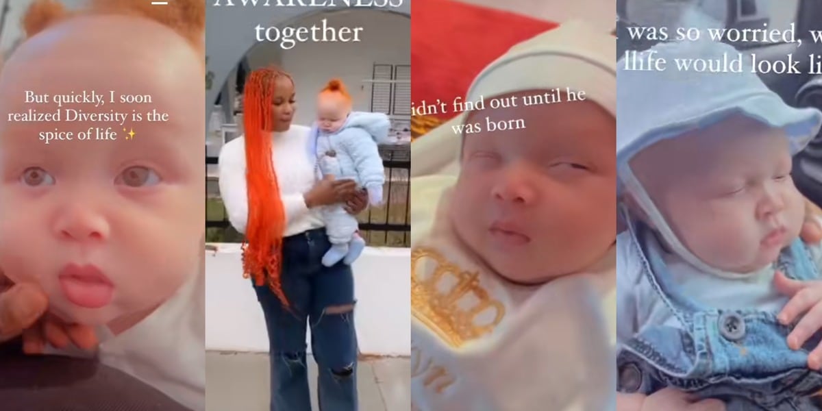 "His red hair, he's so handsome" - Nigerian lady breaks the internet as she shows off handsome son with type 3 albinism
