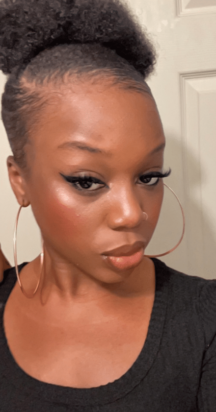 "This is unbelievable" - Nigerian lady stuns many as she shares photo of her face after surviving a fatal car accident