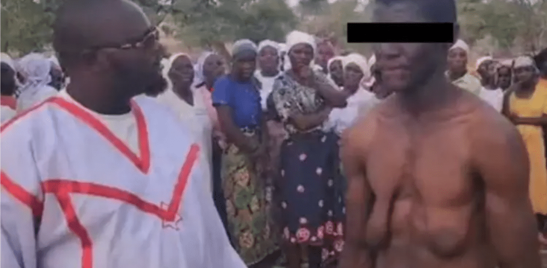 Man grows giant breasts after being sucked by a giant snake every night