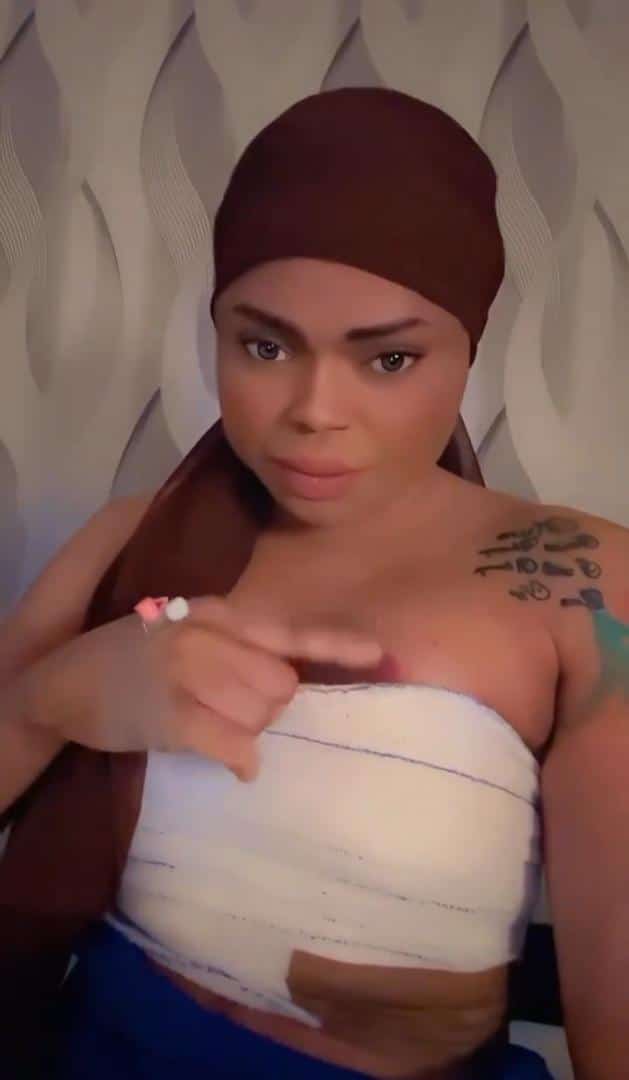 Bobrisky shares update as he reportedly undergoes breast enlargement surgery