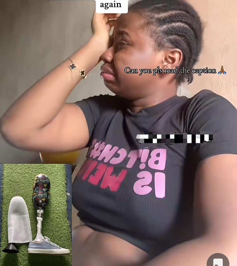Lady breaks down in tears over inability to afford N3.5M prosthetic leg