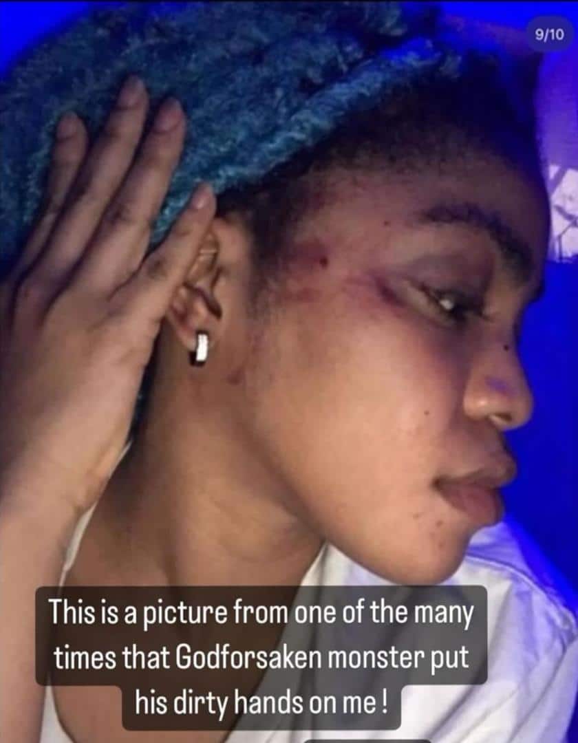"It wasn't just a slap" - Cute Gemini releases more domestic abuse photos