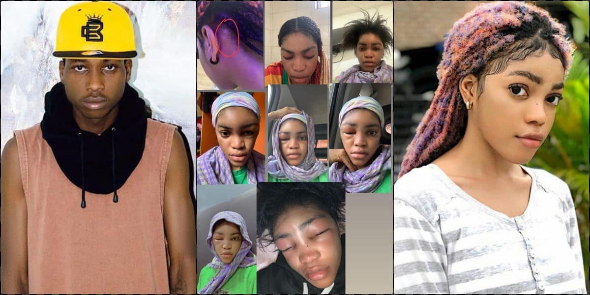 Lil Frosh shares proof, insists swelling on Cute Gemini was allergy not abuse