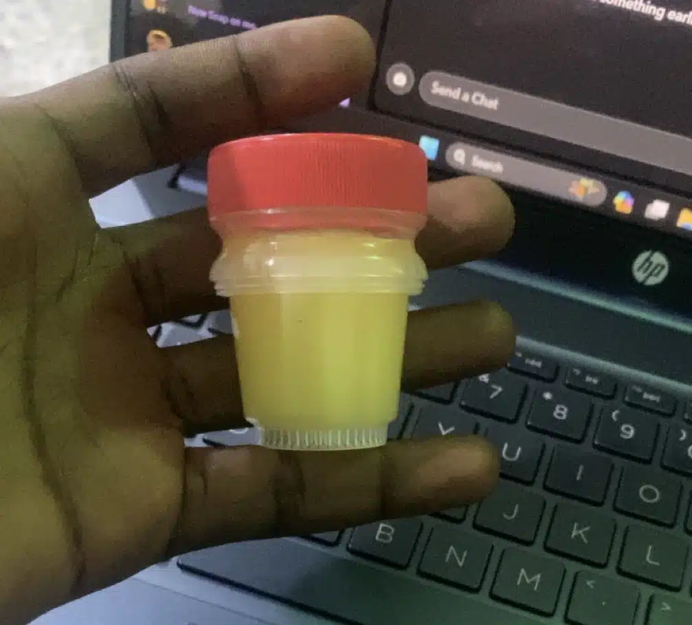 “Daylight robbery” — Man cries out after being deceived by popular ointment packaging 