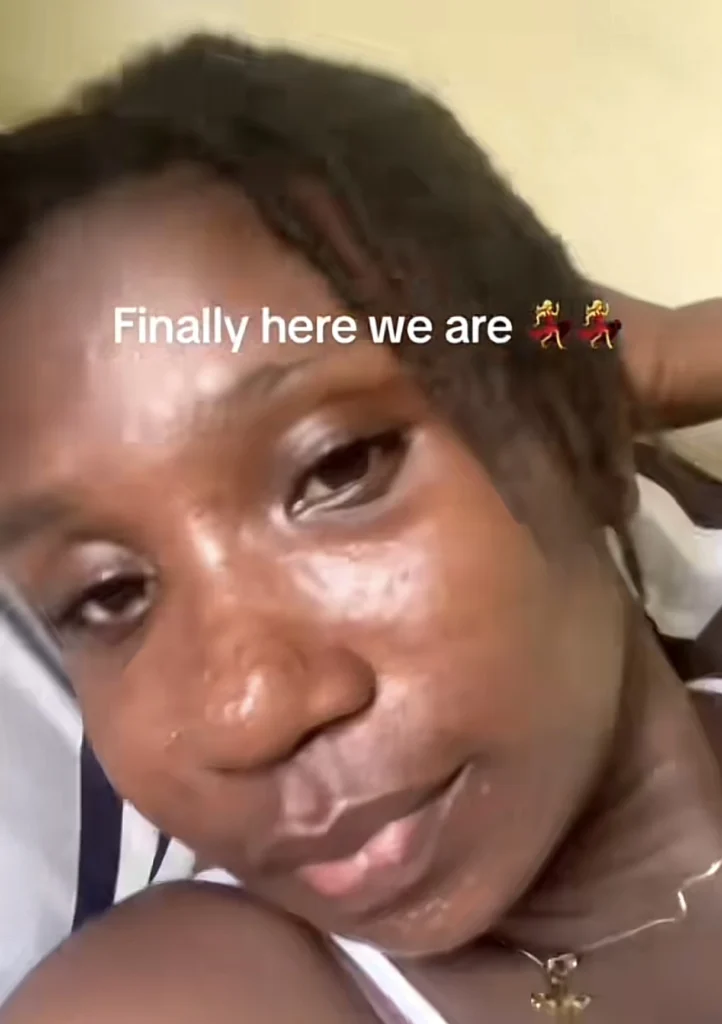 Beautiful lady shares transformation after dealing with intense acne 