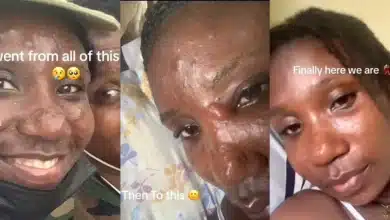 Beautiful lady shares transformation after dealing with intense acne