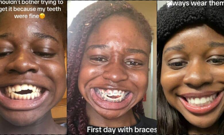 Lady shares beautiful result after wearing braces for five years