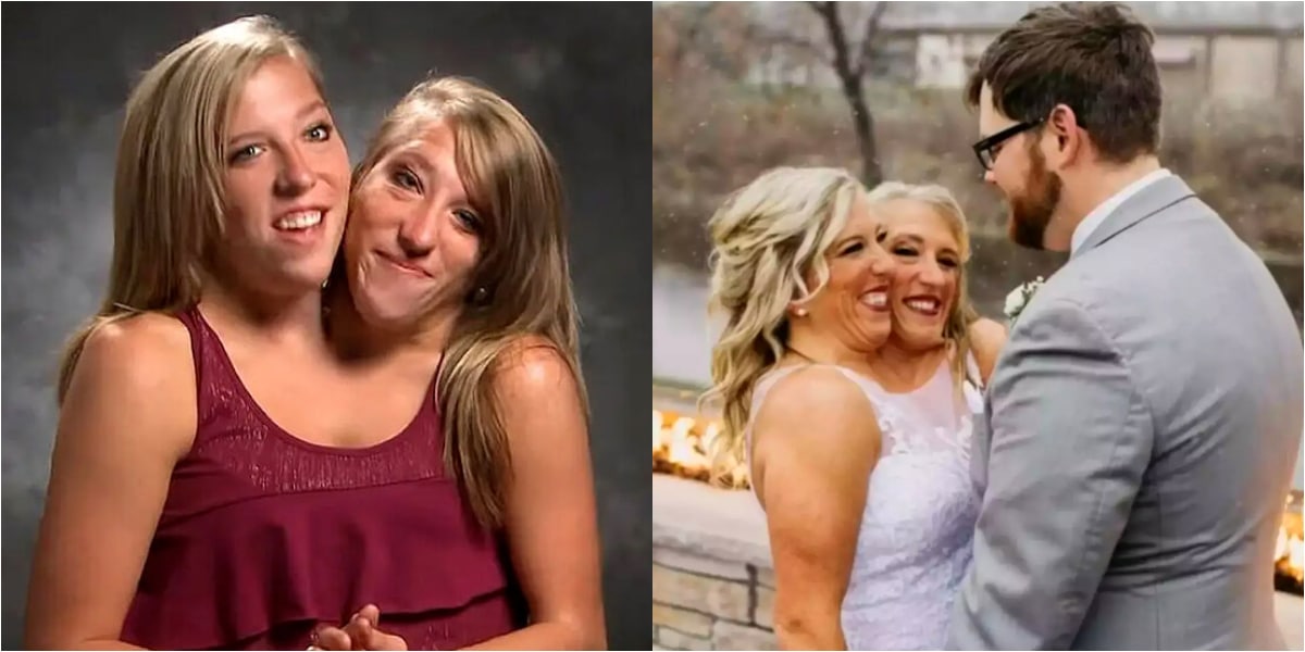 Conjoined twins, Abby Hensel married in a private ceremony