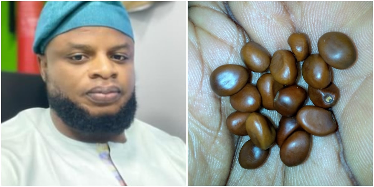 "What could it be?" - Man shares photo of strange seed found in dead uncle's bag