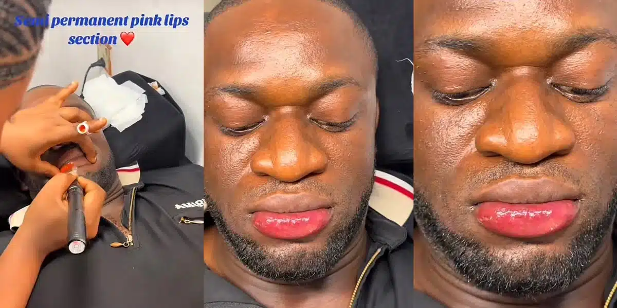 “Go for permanent money not this one” — Reactions as man undergoes beauty process to get semi permanent pink lips