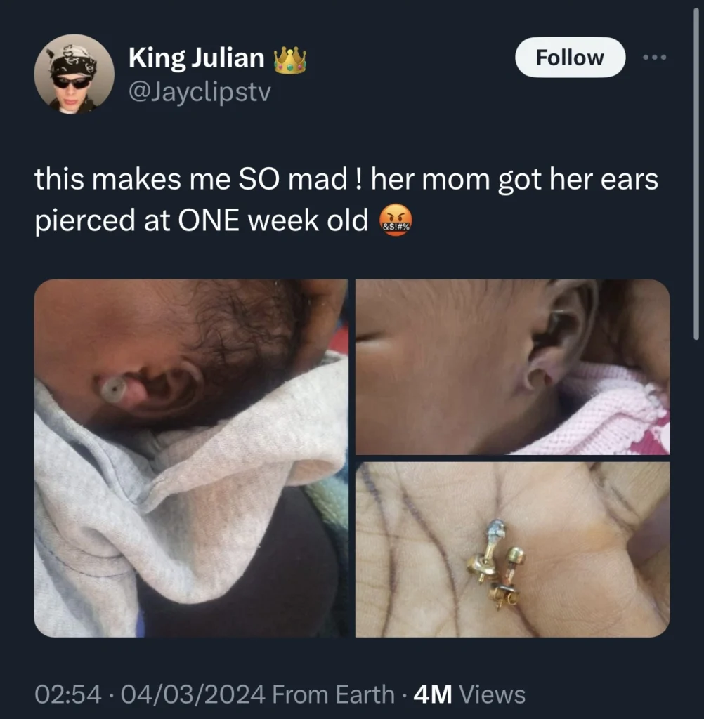 New born nearly loses ear after her mom pierced it when she was only one week old 