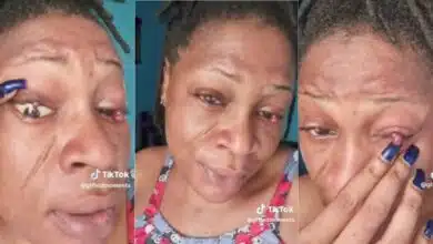"It's becoming scary" – Lady shares how pregnancy affected her eyes