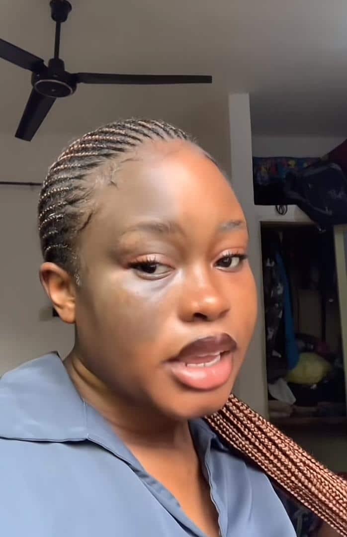 "Some people think I bleached my face" - Lady confidently flaunts birthmark