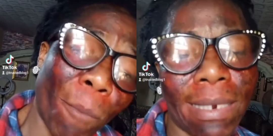 My husband's side chic gave me acid as organic product for face - Woman alleges