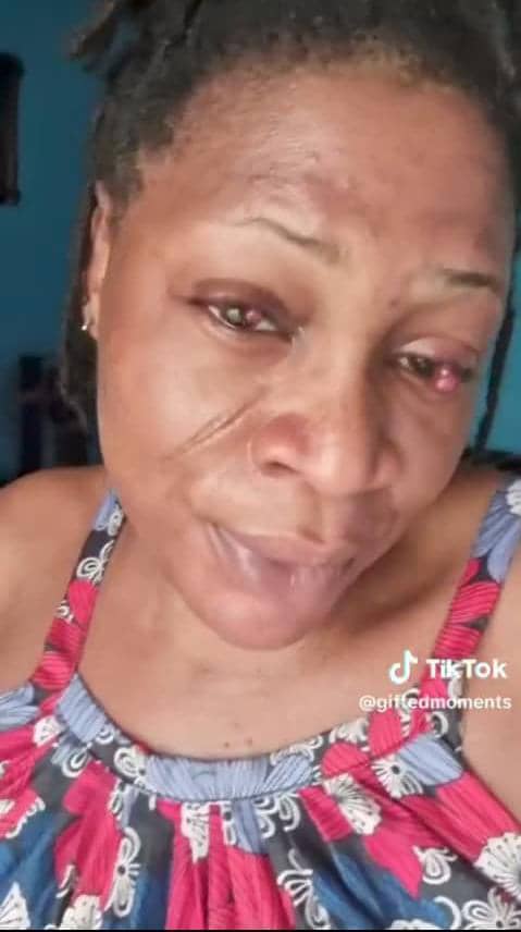 Lady shares how pregnancy affected her eyes