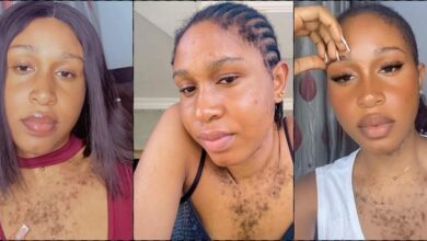 “Maybe in another world I won't be too hairy" - Lady shares struggle, flaunts beauty