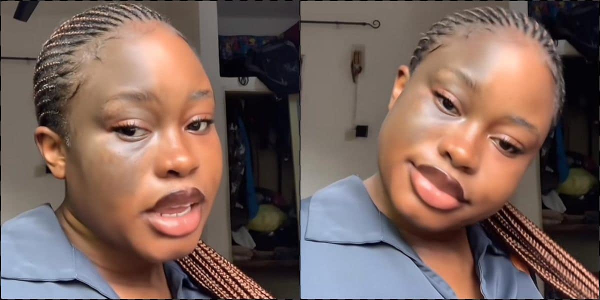 "Some people think I bleached my face" - Lady confidently flaunts birthmark