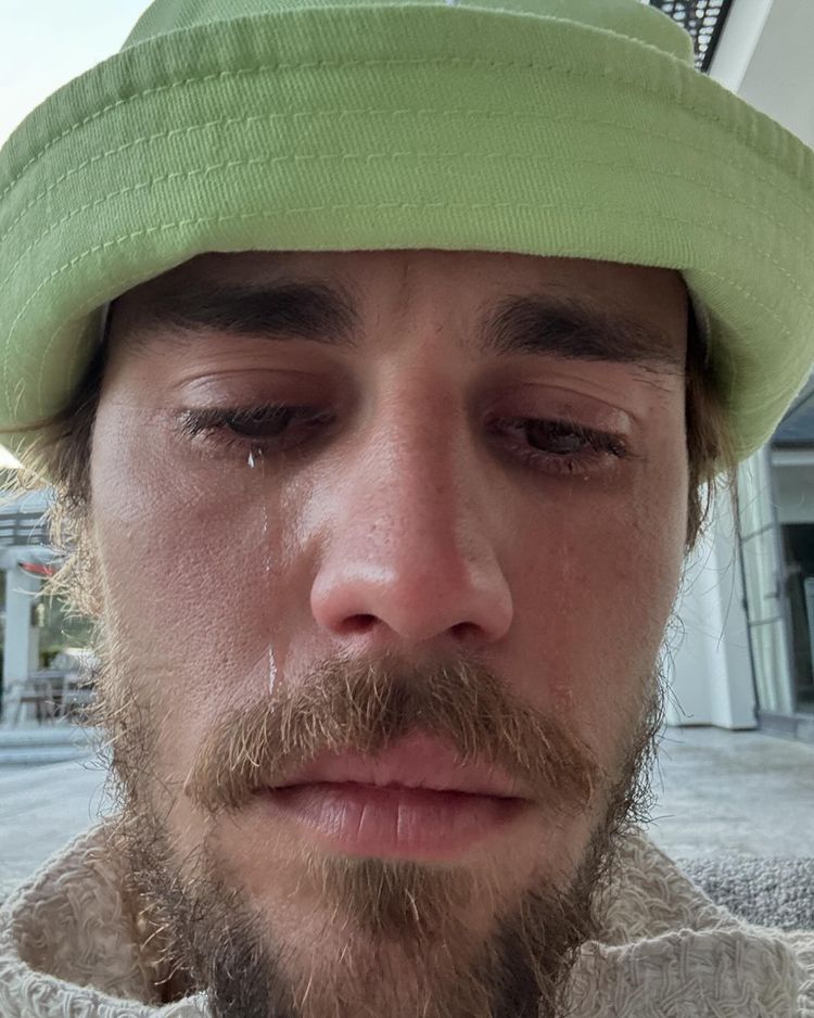 Concerns as Justin Bieber shares photos of himself in tears