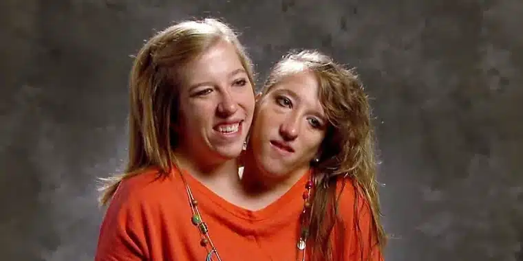 "Yes my husband and I get intimate" - Conjoined twins, Abby Hensel answers questions of curious netizens