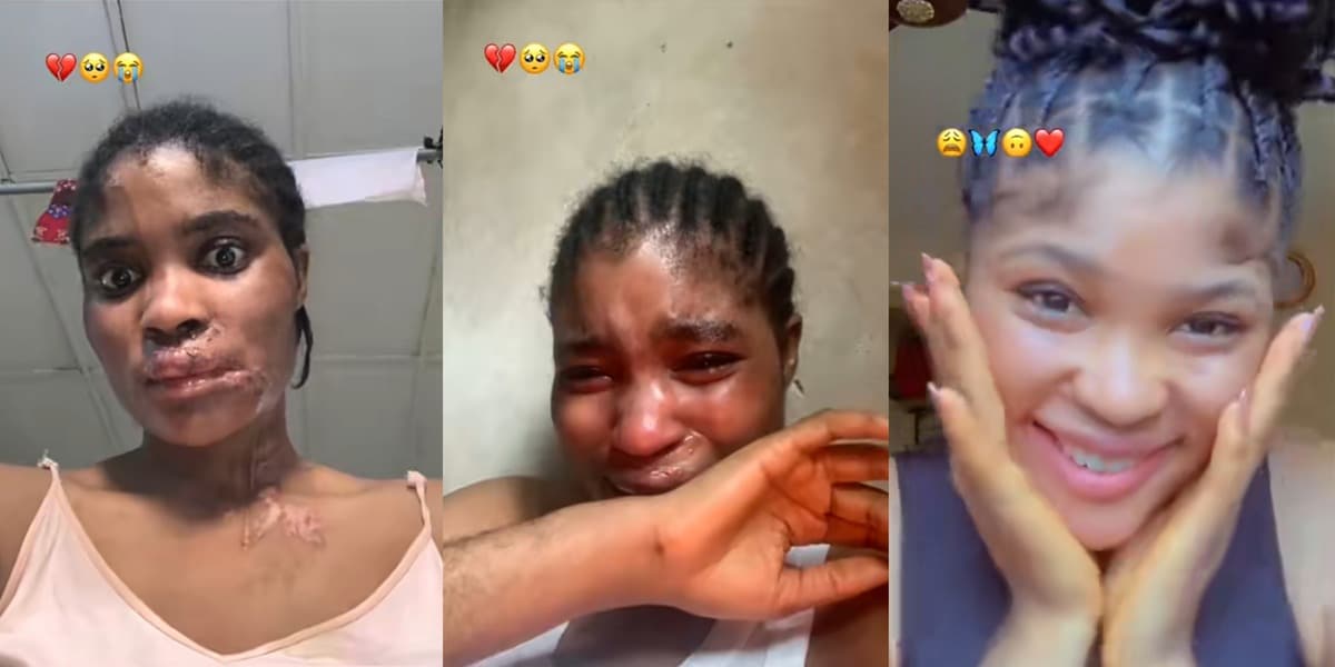 Accident survivor's stunning transformation video goes viral