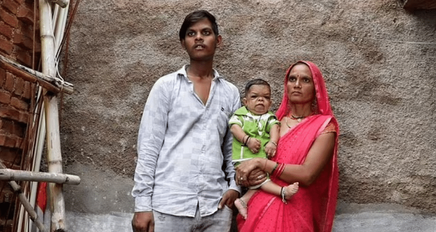 Photo of 25-year-old man who stopped growing in height at age 5 goes viral