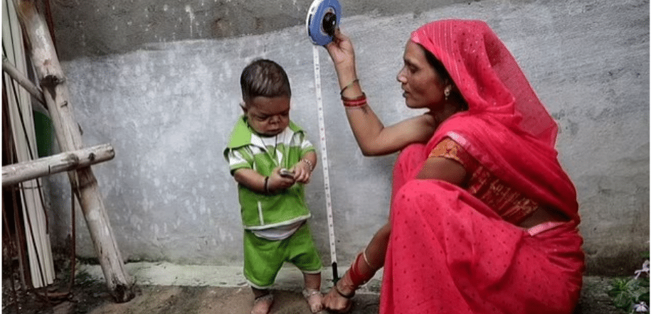 Photo of 25-year-old man who stopped growing in height at age 5 goes viral