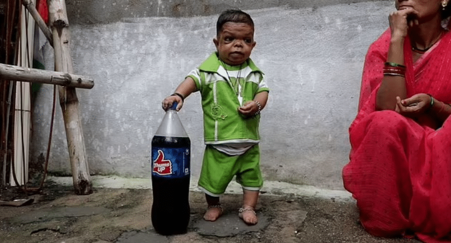 Photo of 25-year-old man who stopped growing in height at age 5 goes viral