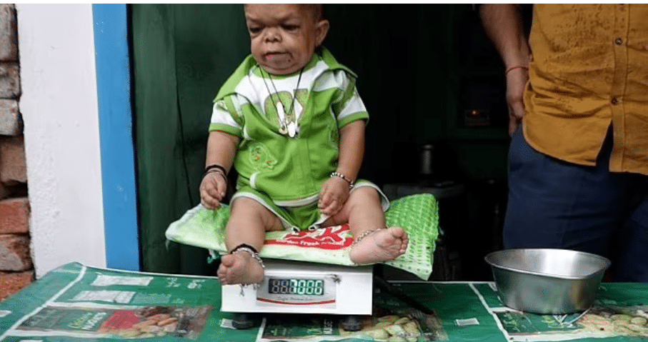 Photo of 25-year-old man who stopped growing in height at age 5 goes viral