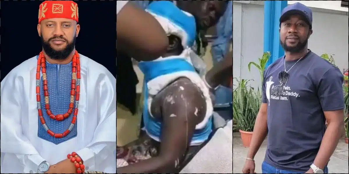 Accident: Yul Edochie calls for help as movie director battles spinal cord injury