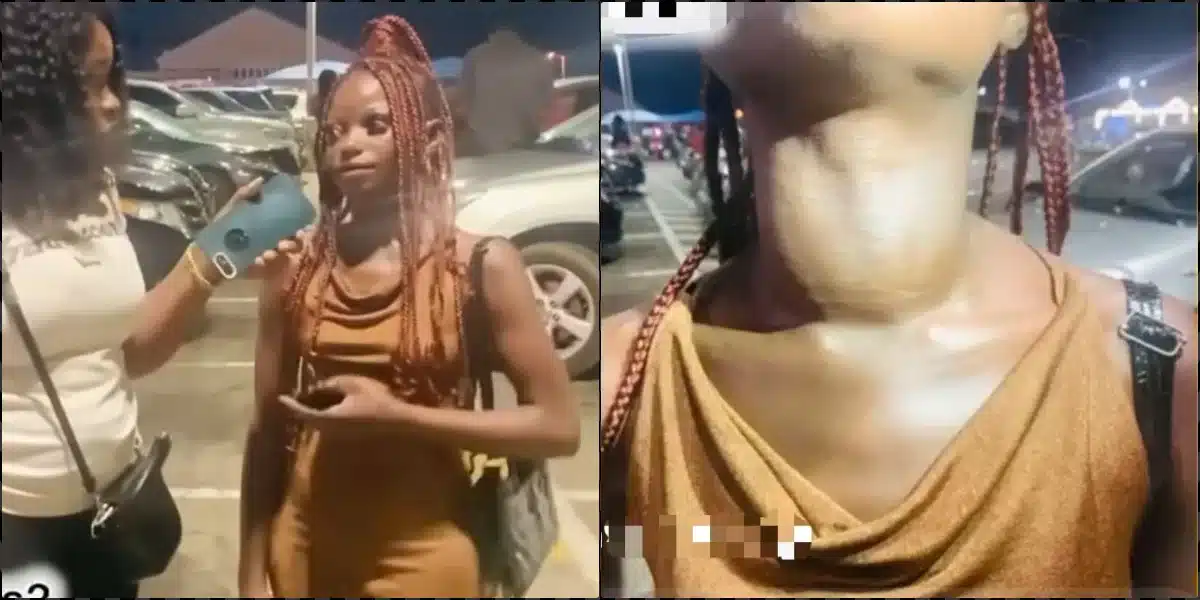 Nigerians crowdfund for lady who does hookup to raise money for goitre surgery