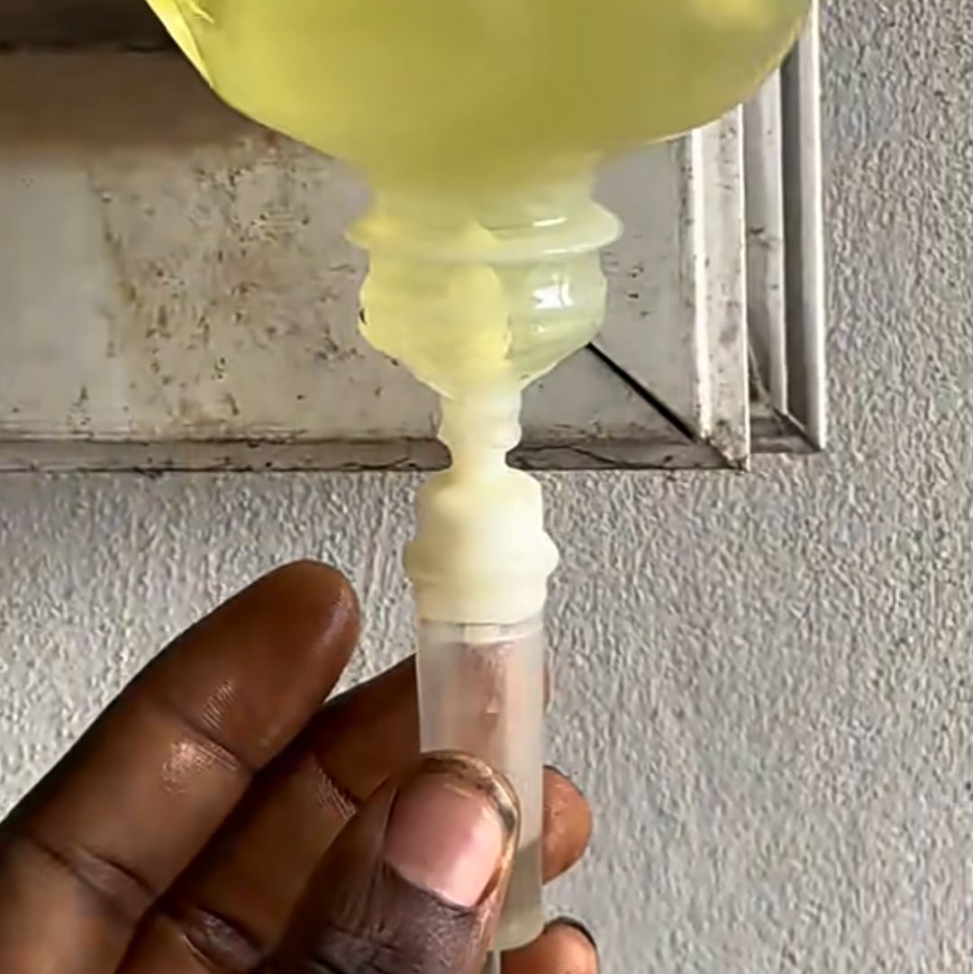 Nigerian man uses IV bag to slowly drip fuel into generator to reduce consumption