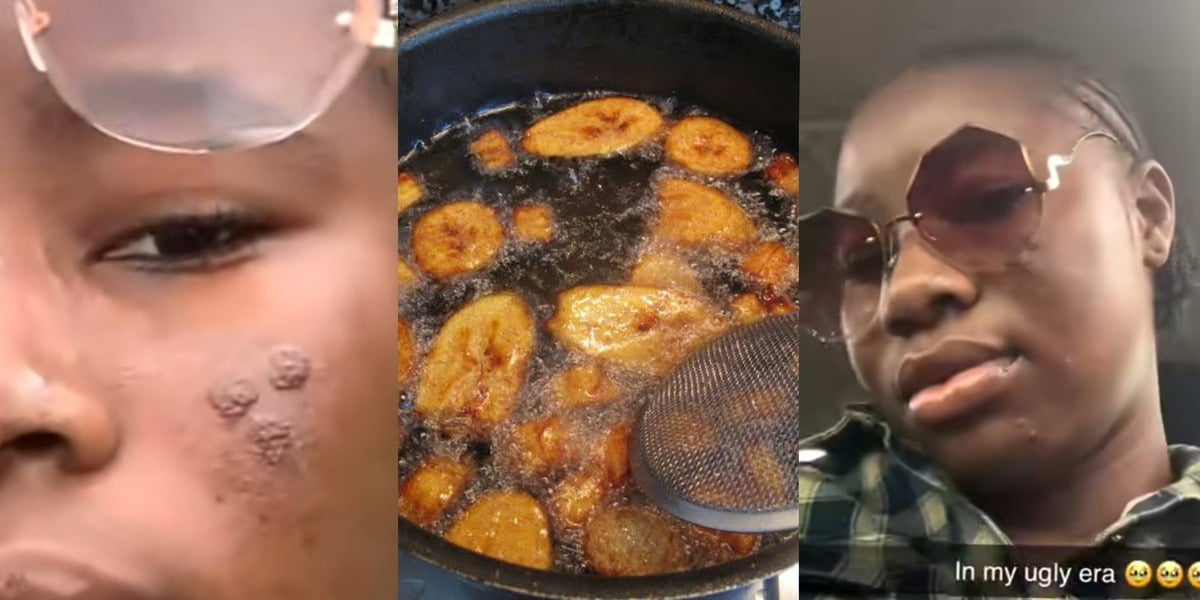 Nigerian lady risks losing eye while frying plantain for boyfriend