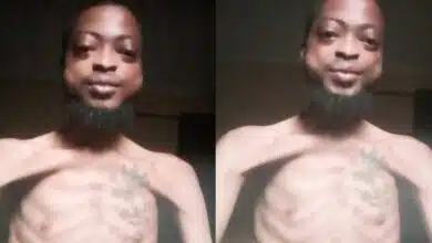 Nigerian man looking malnourished cries out for help over hunger