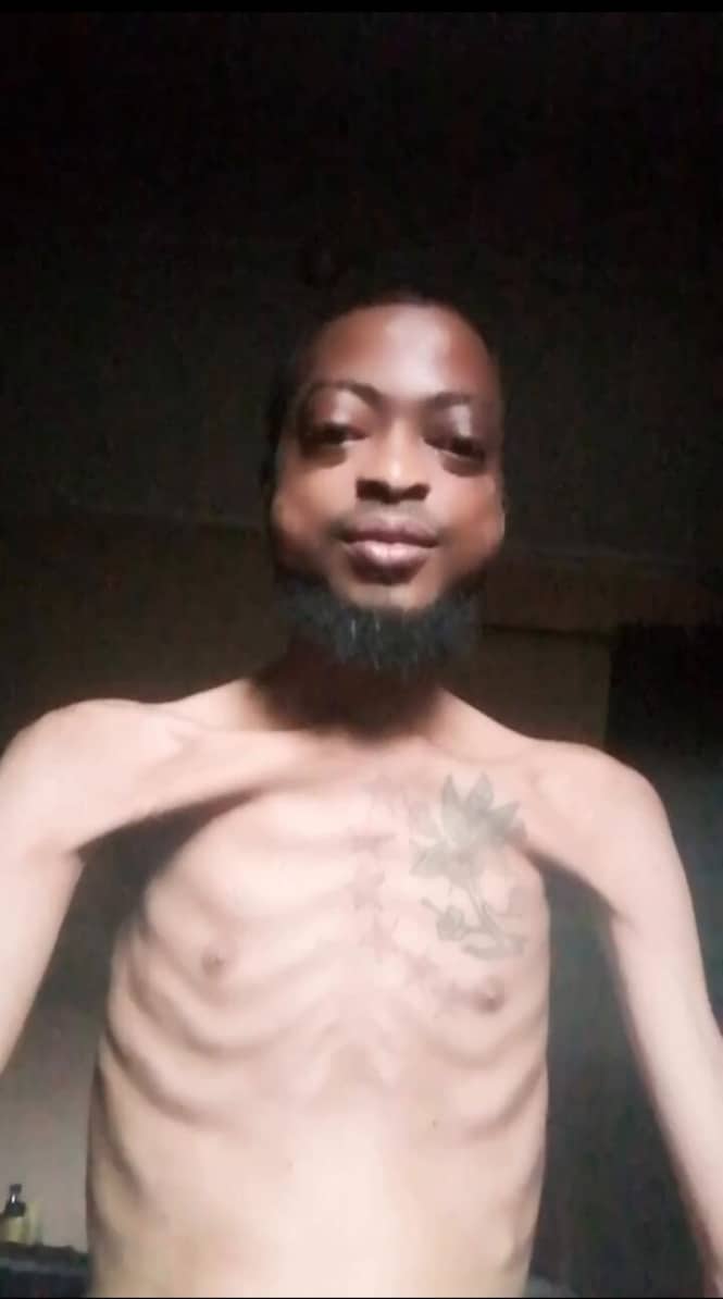 Nigerian man looking malnourished cries out for help over hunger
