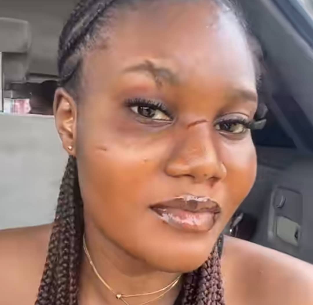 Nigerian lady gets her face redesigned by boyfriend's main girlfriend after unannounced visit to his house
