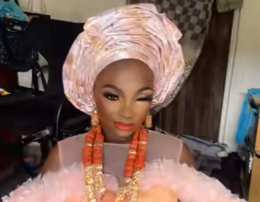 Bride-to-be involved in accident 2 days before wedding, video shocks many