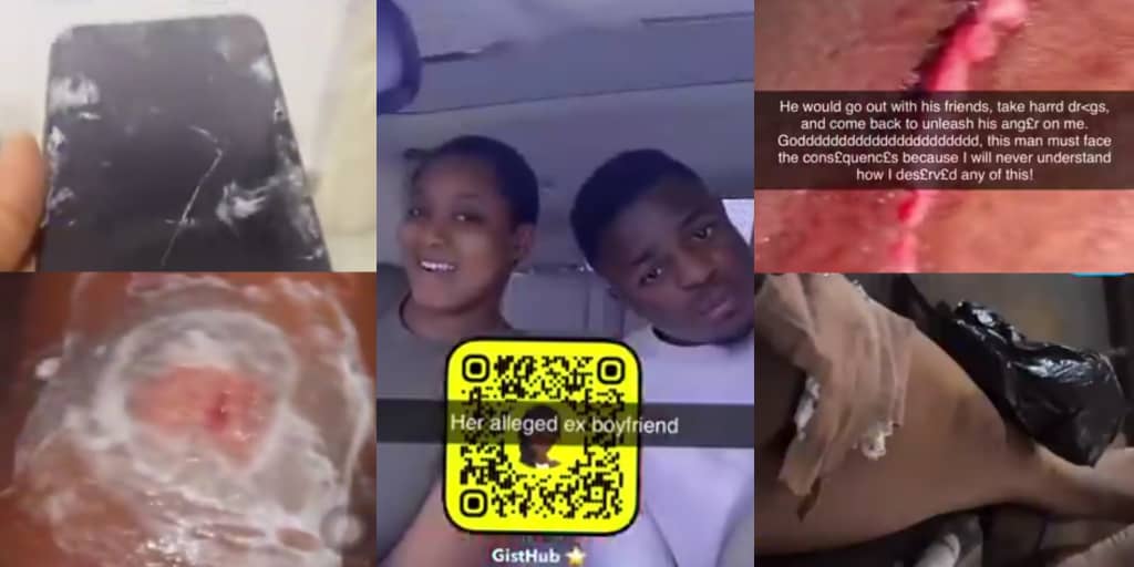 Lady accuses ex-boyfriend physical assault and emotional abuse