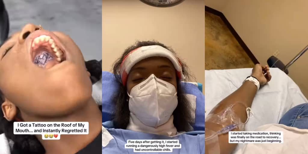 Woman gets permanent tattoo on roof of mouth, develops bloodstream infection