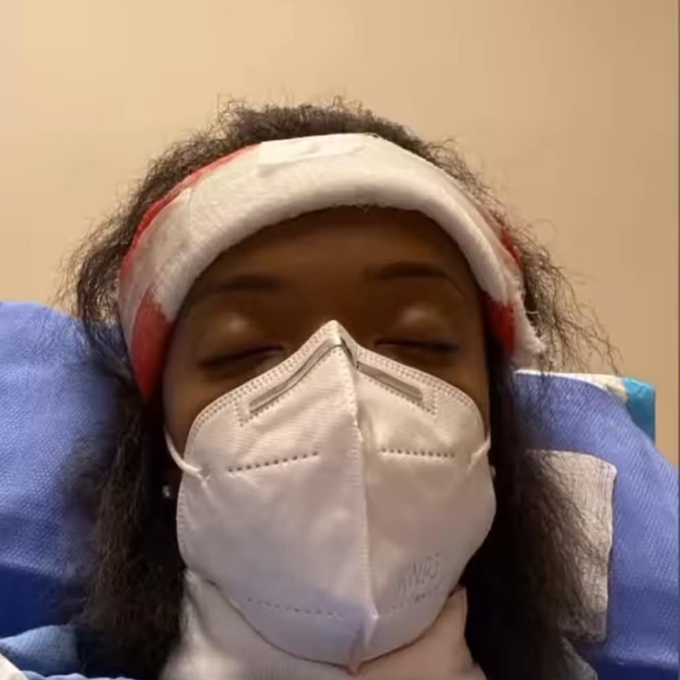 Woman gets permanent tattoo on roof of mouth, develops bloodstream infection