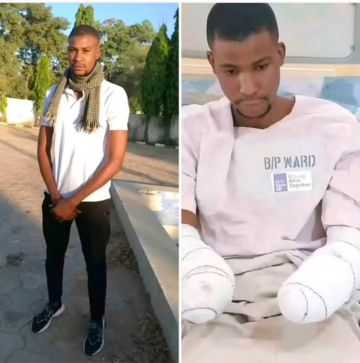 Tragedy as man loses both arms in mechanical accident 5 days after employment