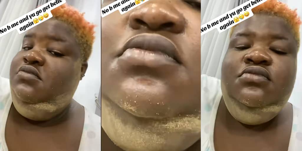 Woman vows never to carry a baby again after disturbing pregnancy condition