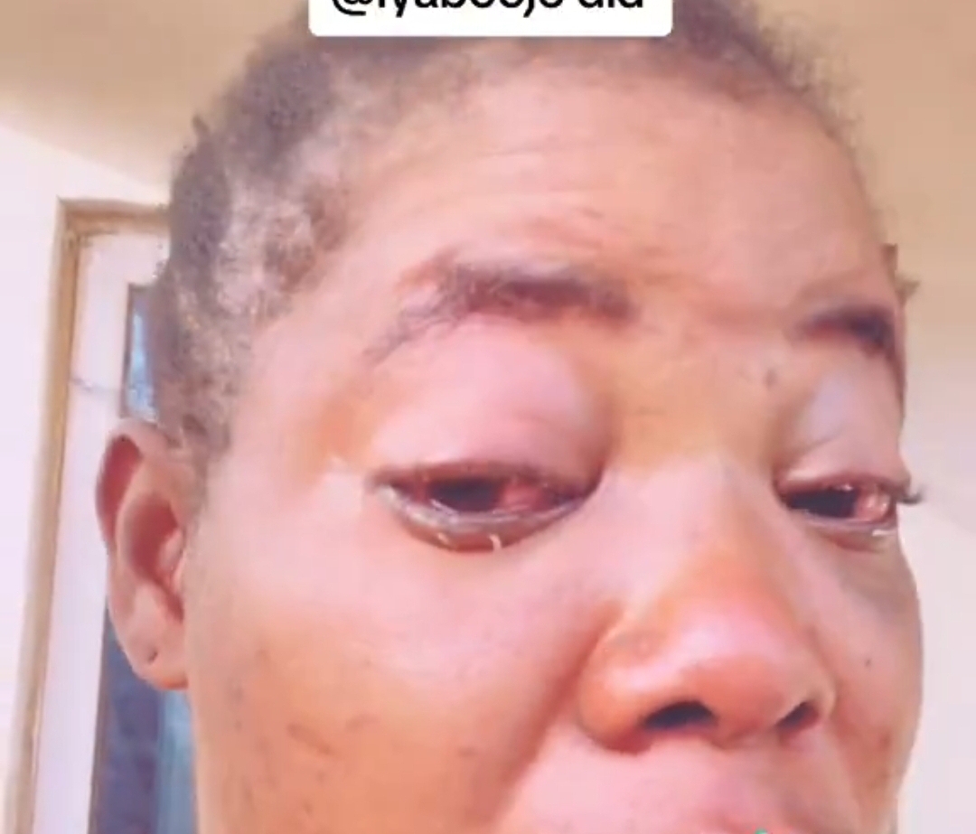 Husband attacks wife after she says her ex will attend wedding of their children