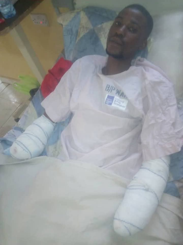Tragedy as man loses both arms in mechanical accident 5 days after employment